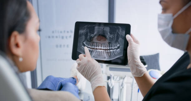 Licensed Tooth Extraction service in McDonough, GA - Smile Center Dentistry